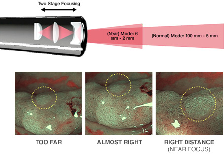 Illustration of scope end and visualization between 6 mm and 2 mm and normal mode between 100 mm and 5 mm above three clinical images of tissue too far, almost right and right (near) focus