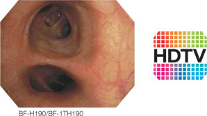 Bronchial airway with caption reading BF-H190/BF-1TH190 next to HDTV icon