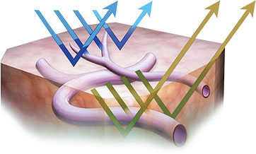 Anatomical 3D illustration of cross section of tissue and GI tract with yellow and blue arrows in a V shape pointing upward