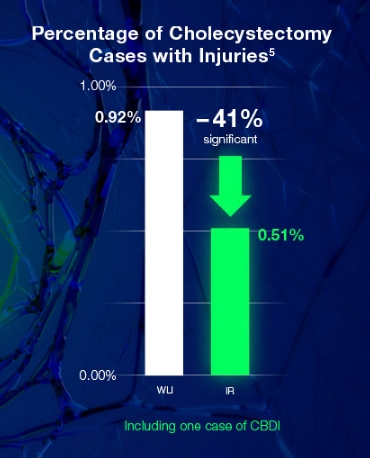Percentage of Cholecysteectomy Cases with Injuries(5)