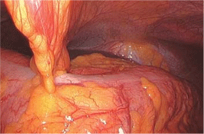 Closeup of complex tissue structure