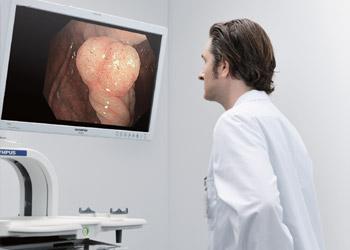 EVIS EXERA™ III for Gastroenterology